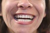 Dental care. Hur mycket tänder som du har?.