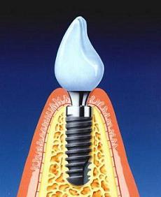 Teeth care and teeth treatment. Dental care.