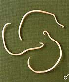 This is 
a roundworm, which is an example of an invertebrate in the Nematoda phylum