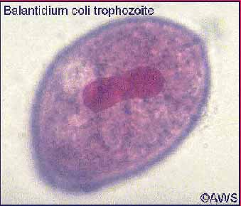 trofozoíto de balantidium coli 400x