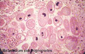 trofozoíto de balantidium coli 400x