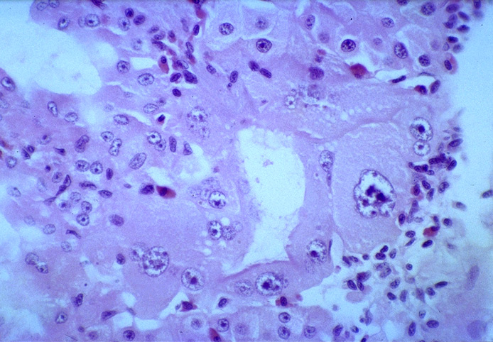 light-micrograph-of-multi-and-mononucleated-giant-cells-in-antennal