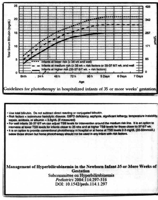 Phototherapy Guidelines  When to treat  35 or more weeks gestation