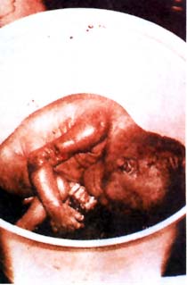 El aborto provocado es siempre asesinato