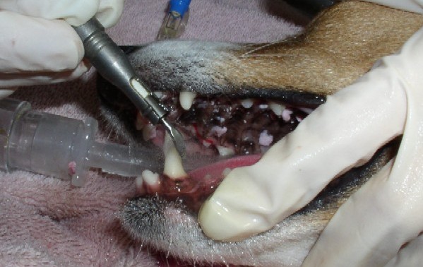 Scaling the teeth with an ultrasonic scaler