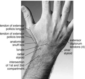 hand snuff box anatomical pain tenderness wrist swelling movements decreased during power