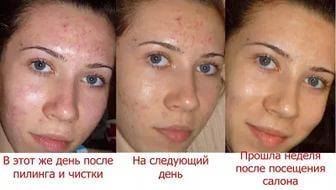 rebels ярославль видео
