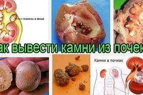 Аппликация бумажная вырубная для объемных рисунков новый год