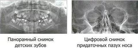 Дженифер арментроут книга обсидиан fb2