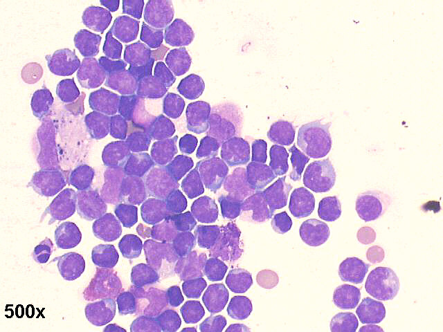 500x M-G-G staining, predominance of lymphocytes