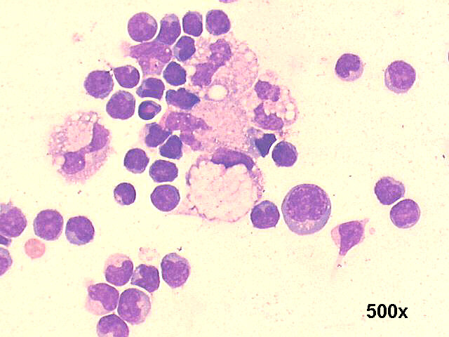500x M-G-G staining, presence of several macrophages