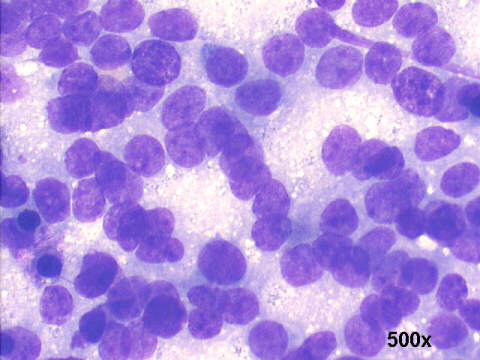 500x M-G-G staining, notice the absence of nucleoli