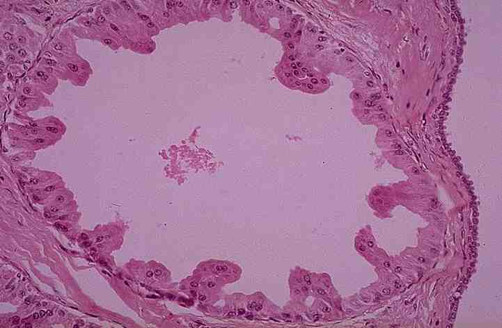 fibrocystic breast changes icd 10 code