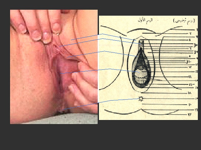 cone pussy bikinis blondes