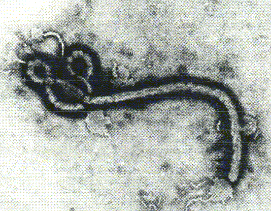 Ebola vrus