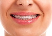 whiten your teeth at home remedies