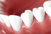 teeth out of alignment symptoms