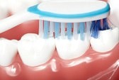 watts power pro 35 teeth whitening gels instructions