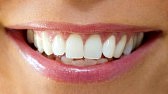 how to whiten teeth at home baking soda and peroxide