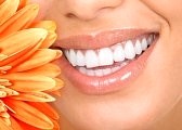 best teeth whitening laser or bleach
