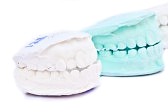 dental whitening before and after