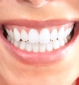 is laser teeth whitening safe during pregnancy