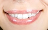 houston teeth whitening reviews