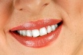 will teeth whitening work on white fillings