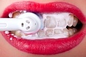 blue light' home laser teeth whitening kit reviews