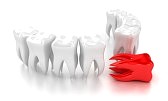 teeth whitening kits reviews 2012