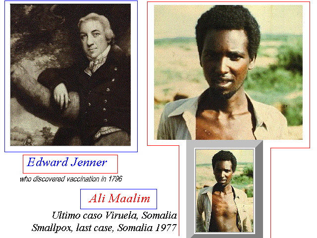 Edward Jenner descubridor vacuna contra viruela, Ali Maalin Ultimo caso