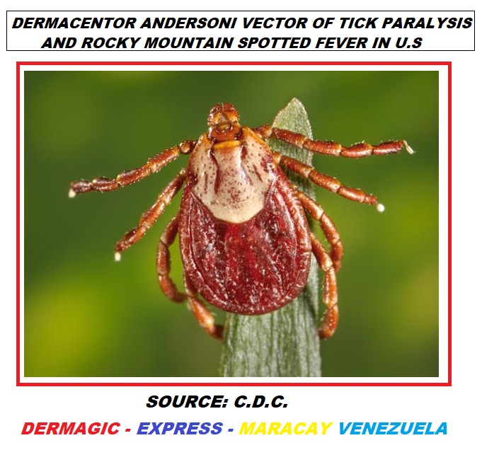Tick Dermacentr Andersoni, vector of Tick Paralysis