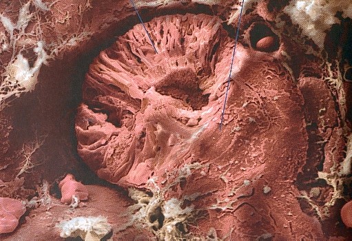 GLOMERULO
