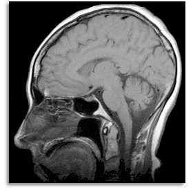 mri