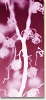 Nefrona