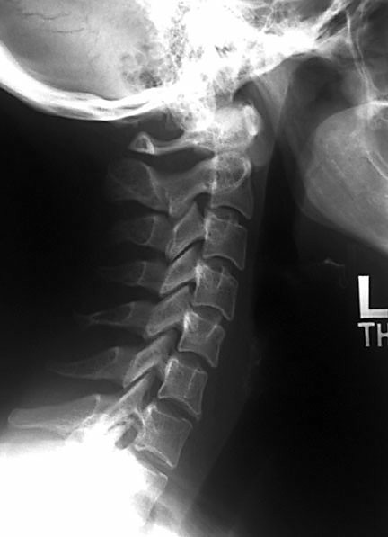 Radiografías simples: una Introducción