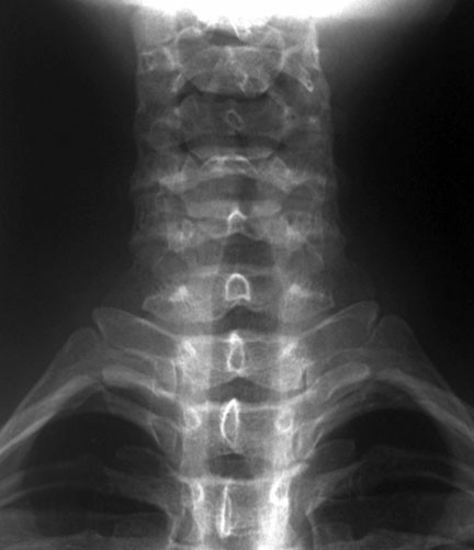 Radiografías simples: una Introducción