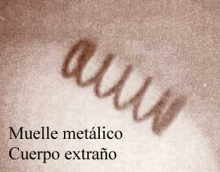 Cuerpo extra�o
