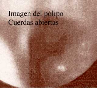 Cuerdas abiertas