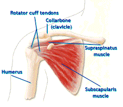 Torn Rotator Cuff