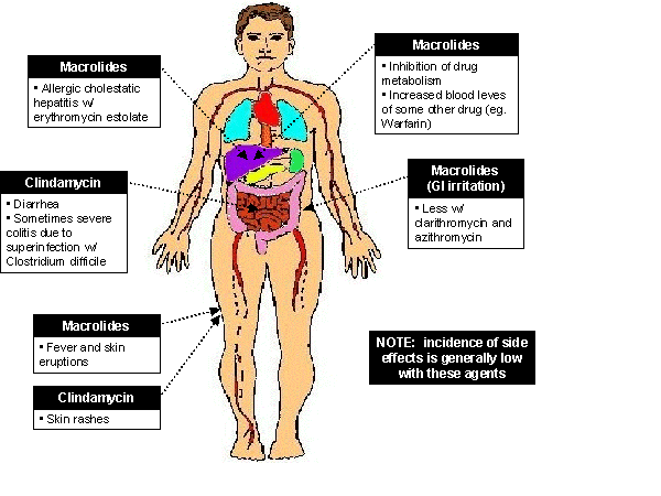 Side Effects of Macrolides and Clindamycin