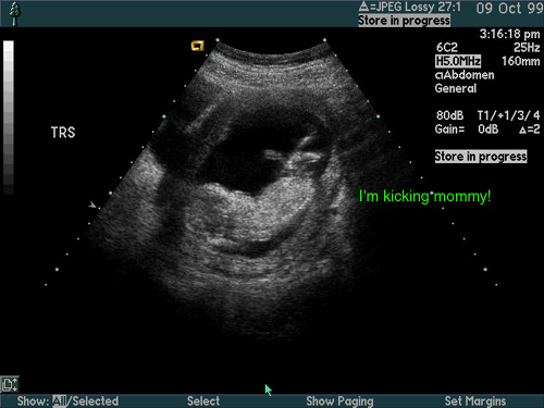 Ultrasounds