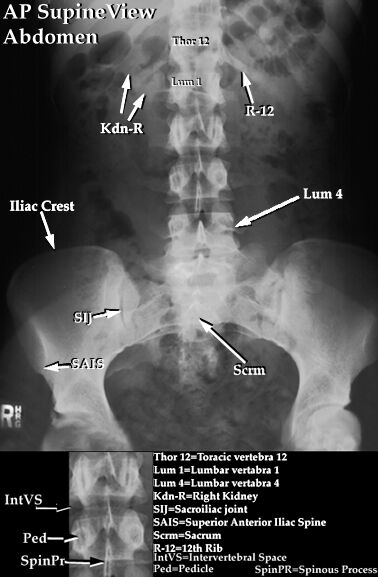 SHAJIL'S MEDSITE: READING X-RAYS