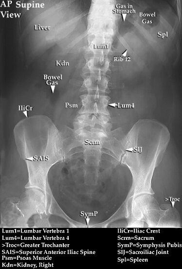 SHAJIL'S MEDSITE: READING X-RAYS