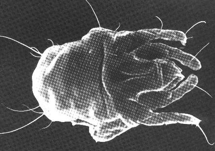Electron microscopy demonstrating a dust mite.